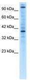 Zinc Finger Protein 624 antibody, TA331813, Origene, Western Blot image 
