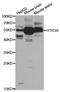 5-Hydroxytryptamine Receptor 3A antibody, abx004318, Abbexa, Western Blot image 