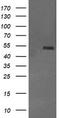 Protein Mdm4 antibody, TA505732AM, Origene, Western Blot image 