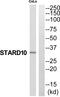 StAR Related Lipid Transfer Domain Containing 10 antibody, PA5-39579, Invitrogen Antibodies, Western Blot image 