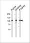 Membrane Metalloendopeptidase antibody, A04065, Boster Biological Technology, Western Blot image 