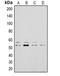 LYN Proto-Oncogene, Src Family Tyrosine Kinase antibody, orb318762, Biorbyt, Western Blot image 