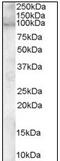 ADAM Metallopeptidase Domain 12 antibody, AP08971PU-N, Origene, Western Blot image 