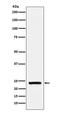 CSN1S1 antibody, M07562, Boster Biological Technology, Western Blot image 