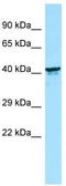 Killer cell immunoglobulin-like receptor 2DL5B antibody, TA338338, Origene, Western Blot image 