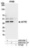 Actin Related Protein 2 antibody, A305-217A, Bethyl Labs, Immunoprecipitation image 