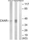 CXADR Ig-Like Cell Adhesion Molecule antibody, A30628, Boster Biological Technology, Western Blot image 