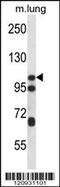 Catenin delta-2 antibody, 56-497, ProSci, Western Blot image 