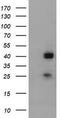 Alpha-1,4-N-Acetylglucosaminyltransferase antibody, CF800399, Origene, Western Blot image 
