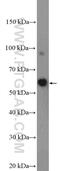 DALR Anticodon Binding Domain Containing 3 antibody, 26294-1-AP, Proteintech Group, Enzyme Linked Immunosorbent Assay image 