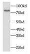 Dipeptidyl Peptidase 8 antibody, FNab02522, FineTest, Western Blot image 