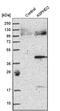 Aspartate Beta-Hydroxylase Domain Containing 2 antibody, PA5-51459, Invitrogen Antibodies, Western Blot image 