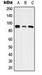 Solute Carrier Family 9 Member A5 antibody, orb215520, Biorbyt, Western Blot image 