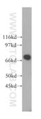 Beta-1,4-N-Acetyl-Galactosaminyltransferase 1 antibody, 13396-1-AP, Proteintech Group, Western Blot image 