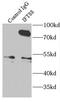 Intraflagellar Transport 88 antibody, FNab04164, FineTest, Immunoprecipitation image 