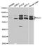 Kinesin Light Chain 1 antibody, MBS2519570, MyBioSource, Western Blot image 