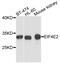 Eukaryotic Translation Initiation Factor 4E Family Member 2 antibody, PA5-76165, Invitrogen Antibodies, Western Blot image 