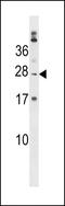 Poly(A) Binding Protein Cytoplasmic 1 Like 2B antibody, LS-C158519, Lifespan Biosciences, Western Blot image 