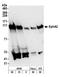 Ephrin type-A receptor 2 antibody, A302-025A, Bethyl Labs, Western Blot image 