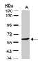 Monoamine Oxidase B antibody, PA5-28338, Invitrogen Antibodies, Western Blot image 