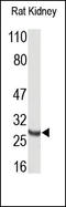 TIMP Metallopeptidase Inhibitor 4 antibody, 251899, Abbiotec, Western Blot image 
