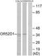 Olfactory Receptor Family 52 Subfamily D Member 1 antibody, A30884, Boster Biological Technology, Western Blot image 