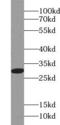 Acidic Nuclear Phosphoprotein 32 Family Member B antibody, FNab00447, FineTest, Western Blot image 