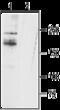 Sodium channel protein type 11 subunit alpha antibody, GTX54806, GeneTex, Western Blot image 