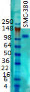 Potassium Voltage-Gated Channel Subfamily B Member 1 antibody, TA326555, Origene, Western Blot image 