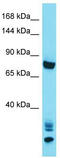 Ankyrin Repeat Domain 36 antibody, TA334878, Origene, Western Blot image 