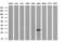 Deoxycytidine Kinase antibody, M01655-1, Boster Biological Technology, Western Blot image 