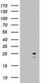 ADP-ribosylation factor-like protein 3 antibody, TA803087S, Origene, Western Blot image 