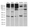 E3 ubiquitin ligase RNF4 antibody, LS-C798897, Lifespan Biosciences, Western Blot image 