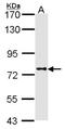 Dipeptidyl Peptidase 8 antibody, NBP1-31256, Novus Biologicals, Western Blot image 
