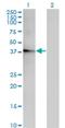 Acyl-CoA Thioesterase 7 antibody, H00011332-M02, Novus Biologicals, Western Blot image 