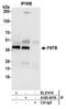 Farnesyltransferase, CAAX Box, Beta antibody, A305-407A, Bethyl Labs, Immunoprecipitation image 