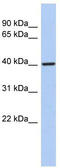 LIM Domain Binding 2 antibody, TA330250, Origene, Western Blot image 