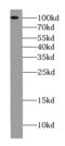 Ubiquitin Specific Peptidase 1 antibody, FNab09303, FineTest, Western Blot image 