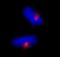 Centrosomal Protein 170 antibody, IHC-00265, Bethyl Labs, Immunohistochemistry paraffin image 