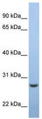 EMC7 antibody, TA338403, Origene, Western Blot image 