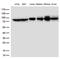 Methylenetetrahydrofolate Reductase antibody, LS-C793066, Lifespan Biosciences, Western Blot image 