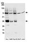 Monocarboxylate transporter 4 antibody, A304-439A, Bethyl Labs, Western Blot image 