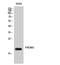 MDS1 and EVI1 complex locus protein EVI1 antibody, A04590, Boster Biological Technology, Western Blot image 