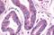 Serine/threonine-protein kinase Nek9 antibody, NBP2-31091, Novus Biologicals, Immunohistochemistry paraffin image 