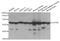 ATP Synthase F1 Subunit Beta antibody, TA332901, Origene, Western Blot image 