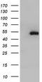 Haptoglobin antibody, TA501697BM, Origene, Western Blot image 