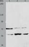 Synoviolin 1 antibody, TA322143, Origene, Western Blot image 