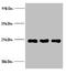 Neutrophil gelatinase-associated lipocalin antibody, A51529-100, Epigentek, Western Blot image 