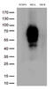 MHC Class I Polypeptide-Related Sequence A antibody, TA813288S, Origene, Western Blot image 