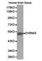 Cholinergic Receptor Nicotinic Alpha 5 Subunit antibody, TA327158, Origene, Western Blot image 